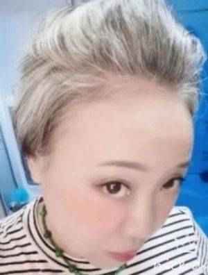 中国生发乌发生物科技创新发明家——刘蔓榕