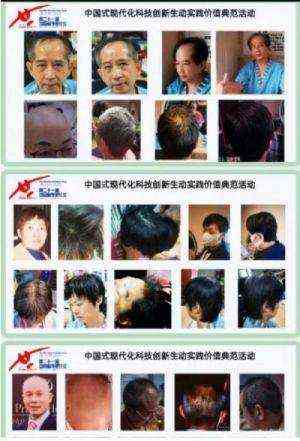 中国生发乌发生物科技创新发明家——刘蔓榕