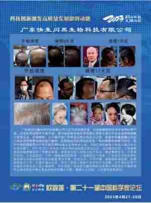 中国生发乌发生物科技创新发明家——刘蔓榕