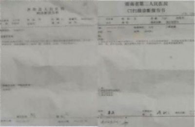 中医药根治恶性肿瘤，癌细胞逆转为正常生理细胞是全人类共同的期盼！