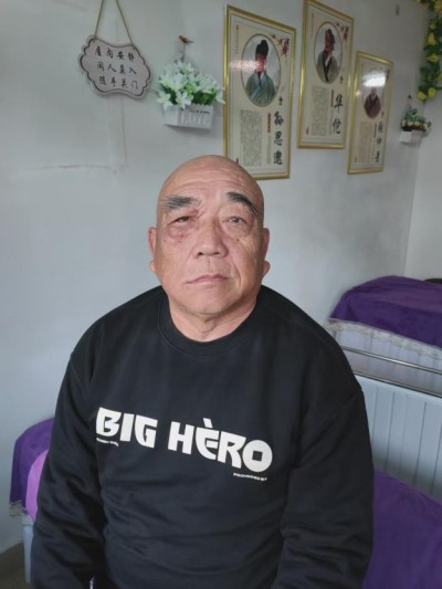 国医名师——金连根