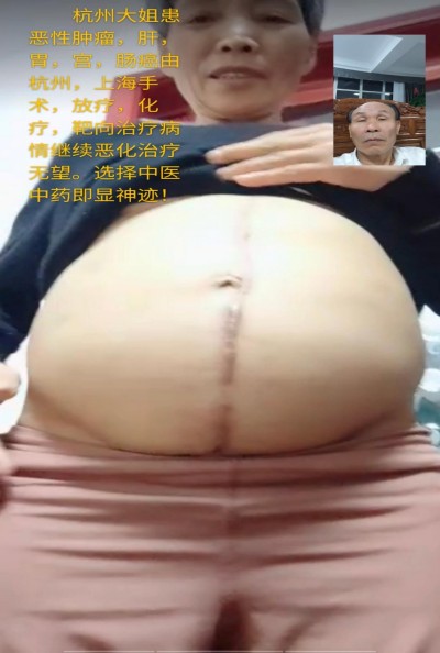 国宝级中医——周培富